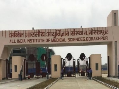 Gorakhpur News : एम्स के डॉक्टर नीरज ने लिखा नया अध्याय ! बिना बेहोश किये की गयी हंसली की सर्जरी