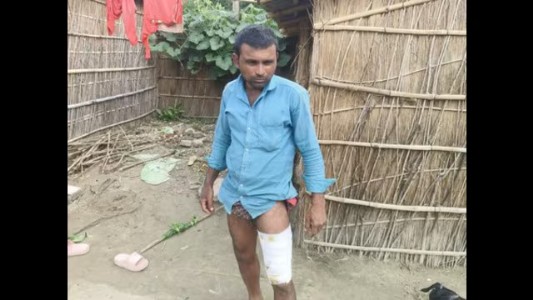 Maharajganj News : मगरमच्छ के जबड़ों में फंसा युवक, ग्रामीणों की समझदारी से यूँ बची जान
